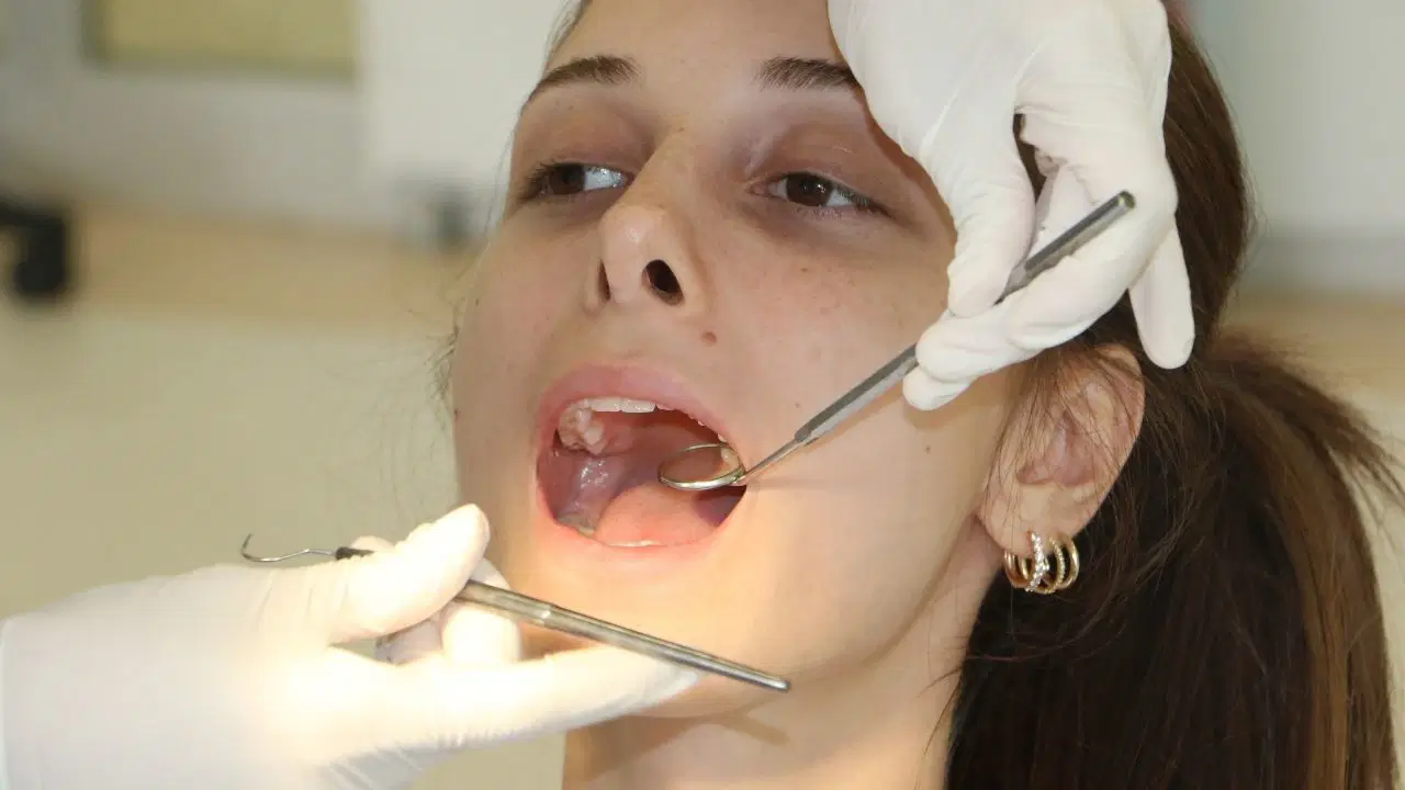 2 haftadan uzun suren agiz yaralari icin dis hekimine basvurulmali iMzKtQq5